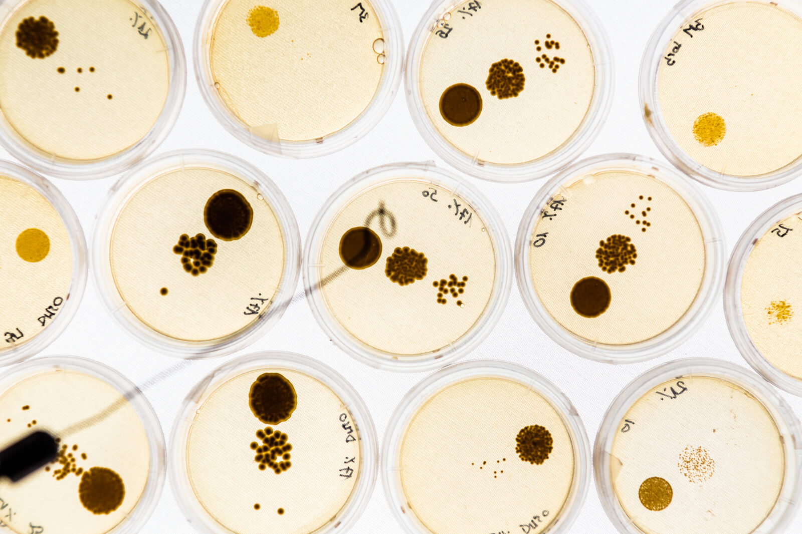 Growing Bacteria in Petri Dishes on agar gel as a part of scientific experiment