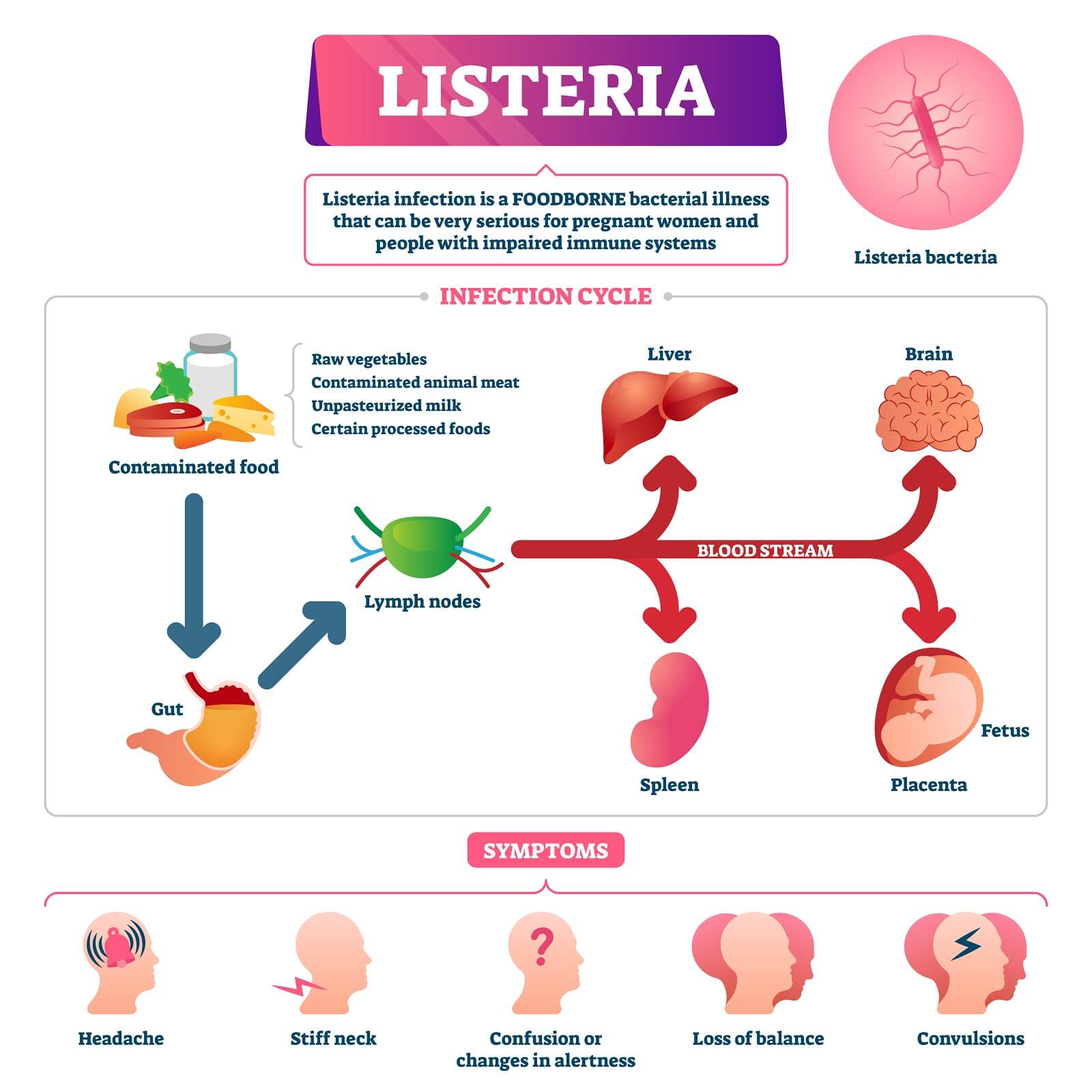 Listeria vector illustration. Labeled educational foodborne bacterial pathogen diagram.