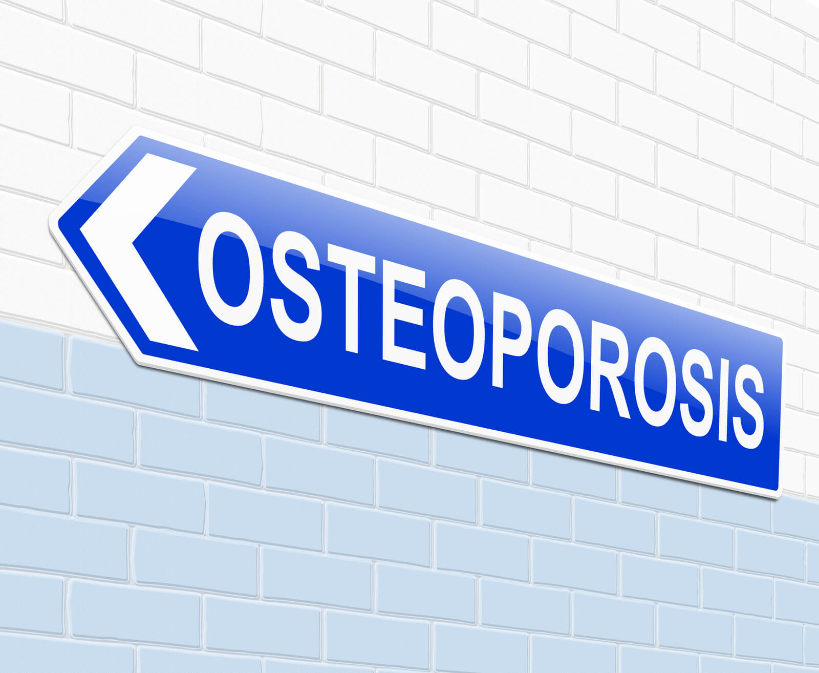 Osteoporosis sign concept art.