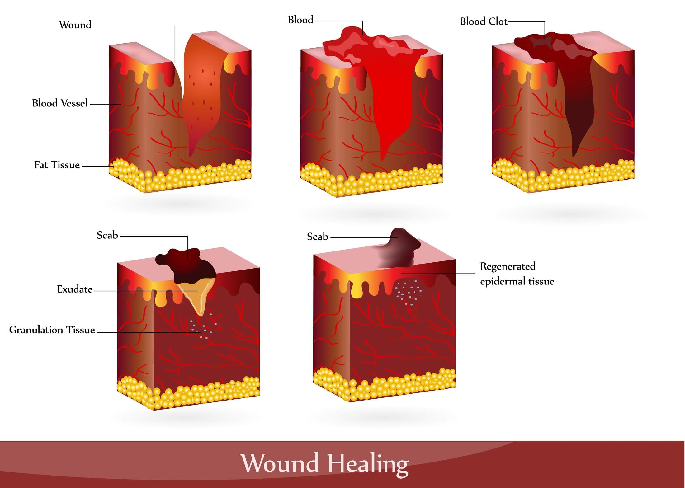 Diagram of the Wound Healing Process